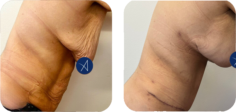 before-after-6